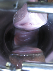VAGINA BOTTOM SPECULUM INSIDE PUSSY PHOTOS