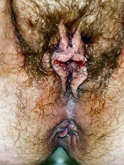 Hairy BBW wife