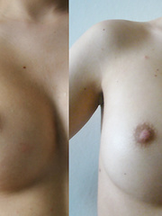 When puffy nipps acquire hard a full set of comparison photos