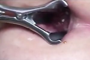 Stretching my girlfriend's taut dark hole with metal speculum