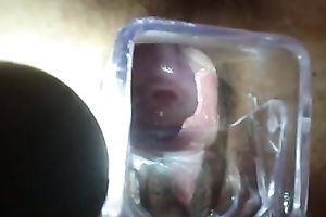 Getting a closeup view of my girl's womb using a speculum
