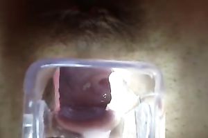 Getting a closeup view of my girl's womb using a speculum