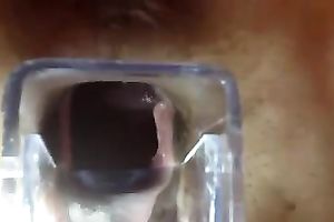 Getting a closeup view of my girl's womb using a speculum