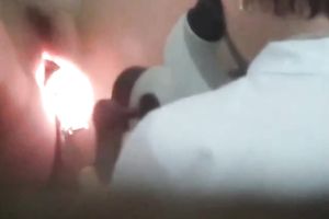 Another random dilettante housewife during the check up at gyno's