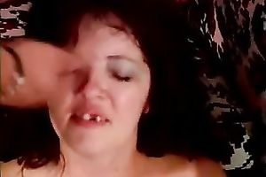 Fat dilettante slut with drilled teeth enjoys anal sex